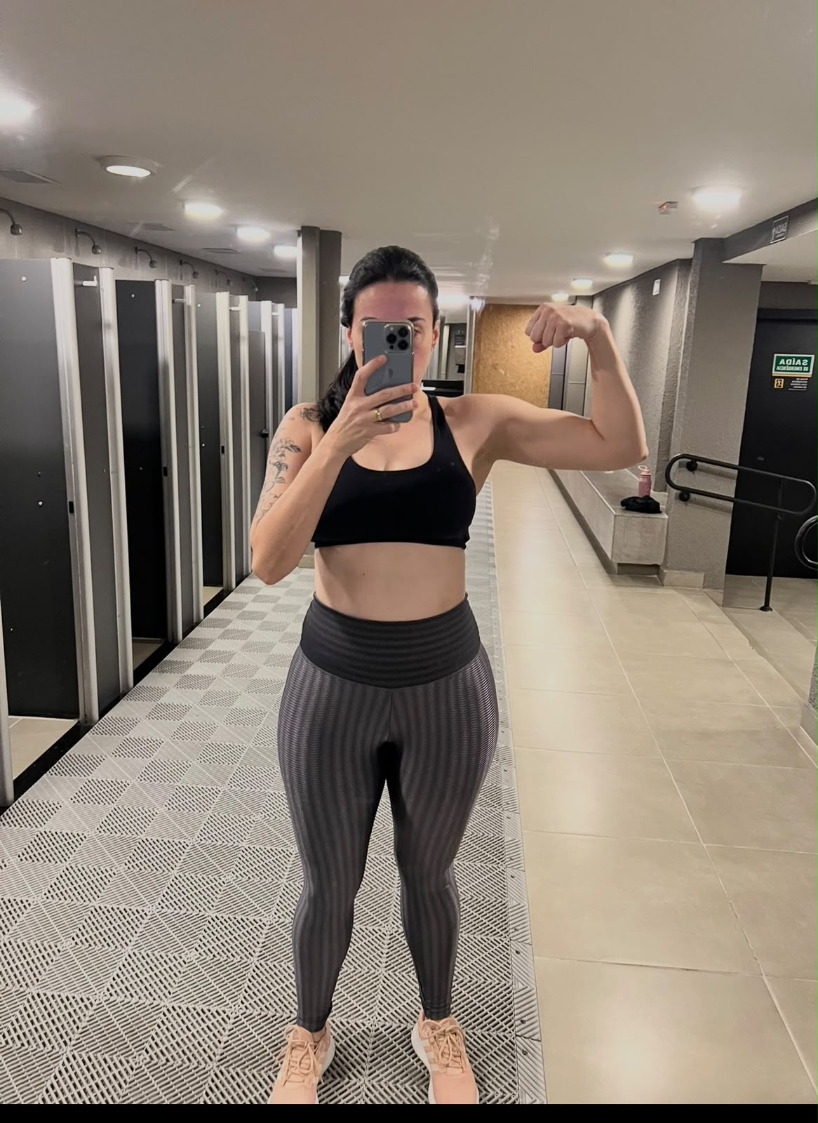 Renata Millar — antes do tratamento